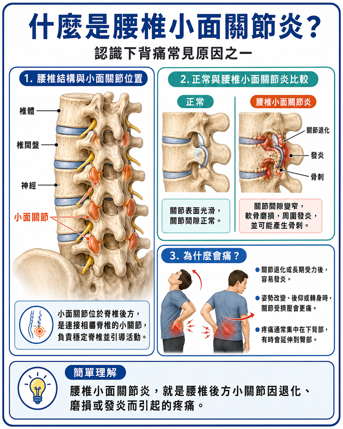 什麼是腰椎小面關節炎