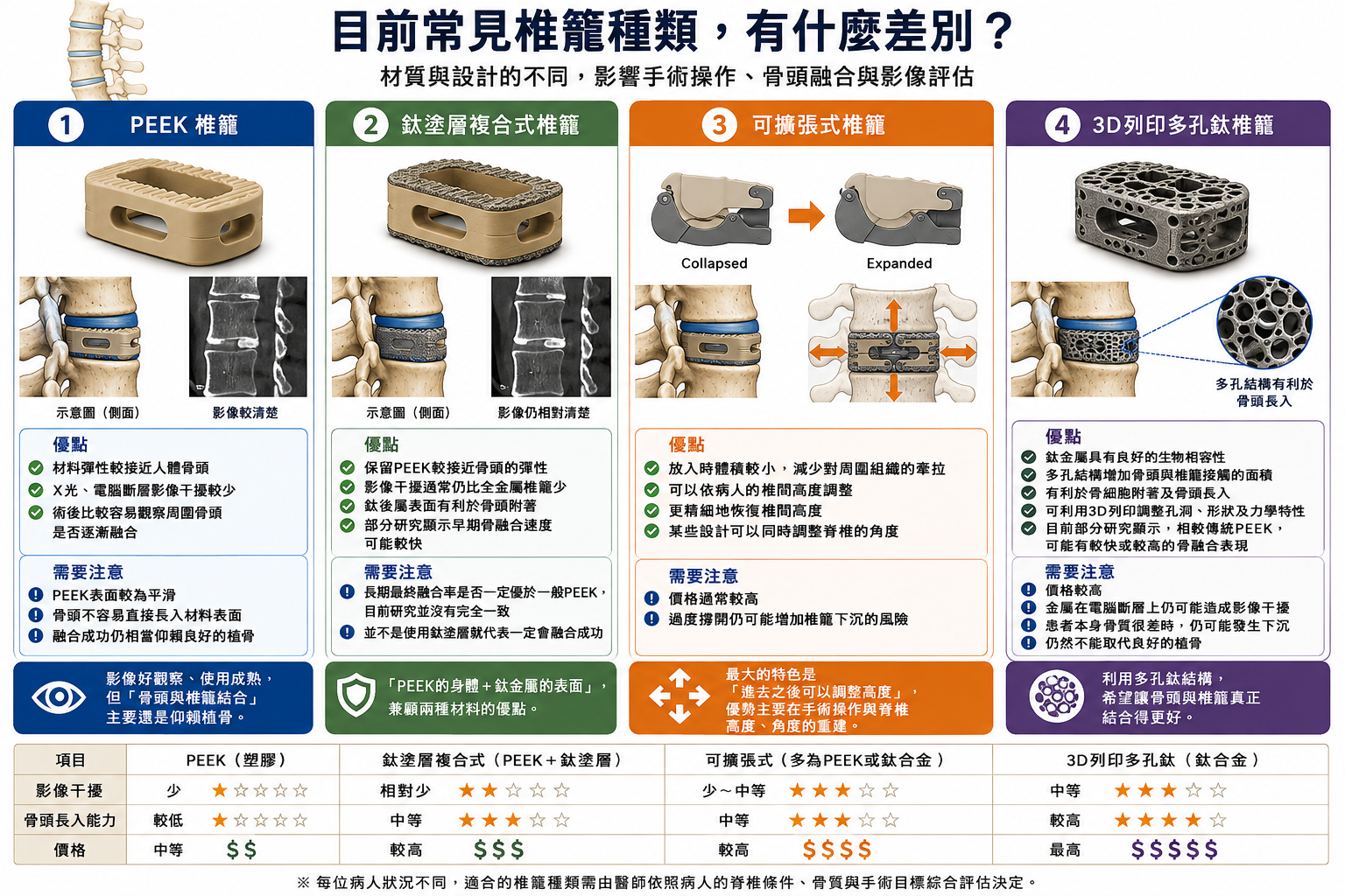 PEEK、鈦塗層複合式、可擴張式與3D列印多孔鈦椎籠比較圖